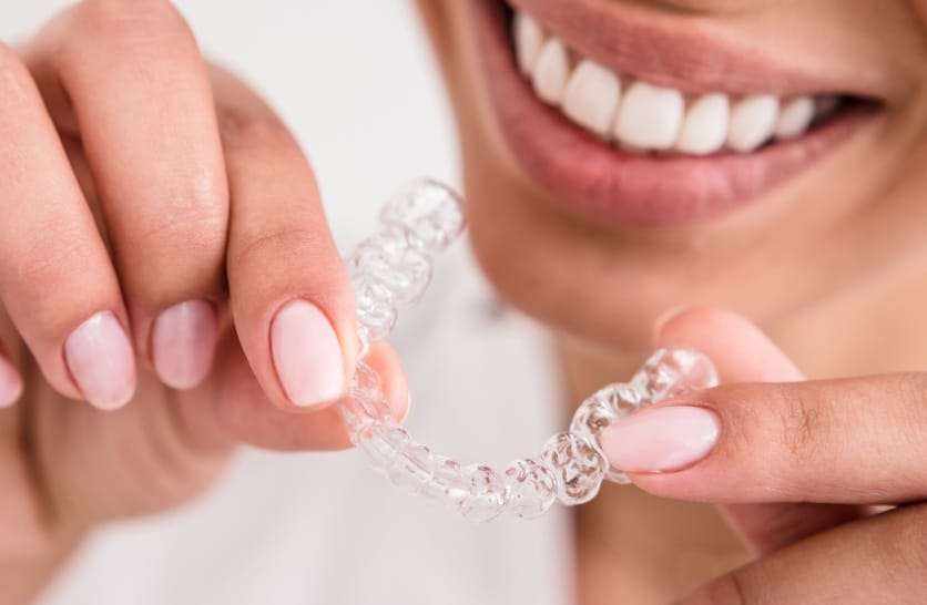 Comment aligner ses dents en toute discrétion à l'âge adulte ? | Dr Sorbol | Lyon l